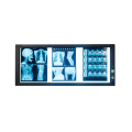 Hot sales high luminance super thin negatoscopio led triple panel medical xray film viewer box